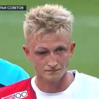 Литвинов повредил глаз в столкновении с Бабичем в игре «Спартака» с «Крыльями»